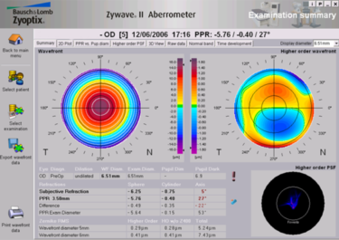 examen aberrométrique (aberrométrie) - centre vision laser maroc