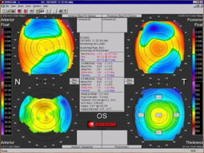 topographie Orbscan - Centre Vision Laser Maroc