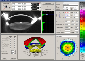 Plateau technique - centre vision laser
